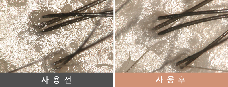 頭皮汚れのBefore After｜ナノバブル シャワーヘッド MYTREX HIHO FINE BUBBLE+ MYTREX　マイトレックス